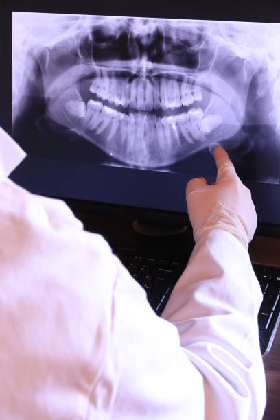 Best Knocked-Out Tooth Emergency  in Riverview, MO