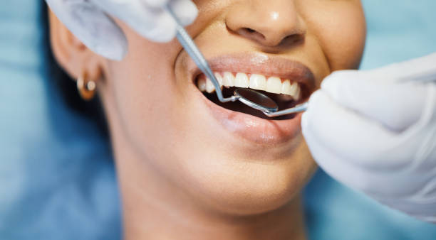Best Chipped Tooth Repair Near Me  in Riverview, MO